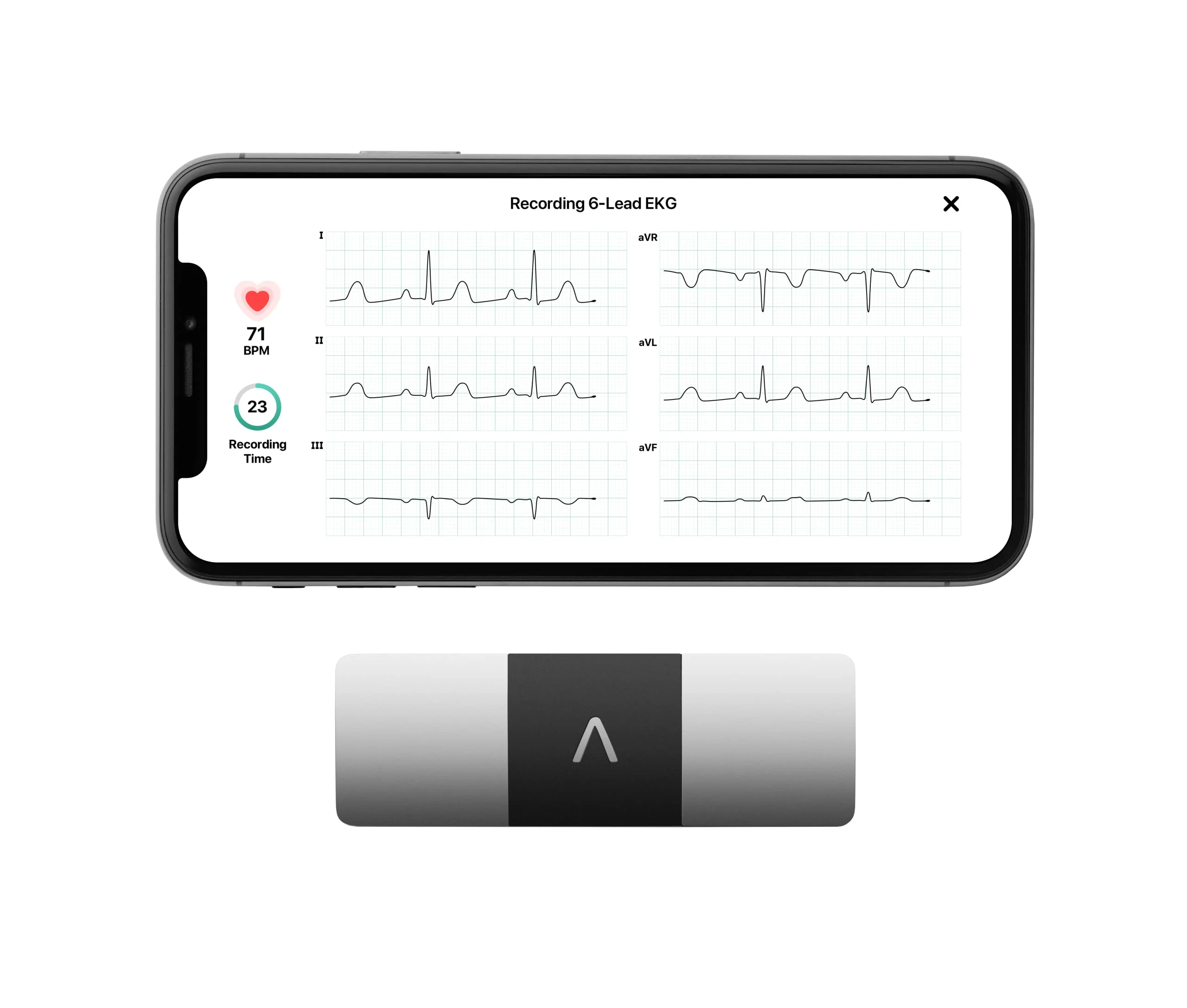 3bf5112cbfbf89a83da6dbb60fddbc5b908afc840bf58429e456a73f0e317dbc KardiaMobile 6L Personal EKG Monitor with Most Smartphones(Default/ONESIZE)