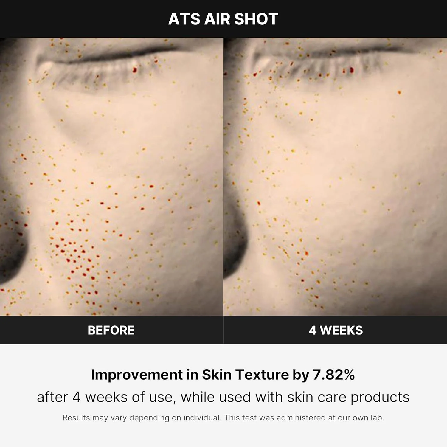 6ef691afe1cab882327810b1035f328232d669cb2fc918655af9199b8f82d729 Medicube Age-R ATS Air Shot - Microneedling Pore Tightening Skin Care Device